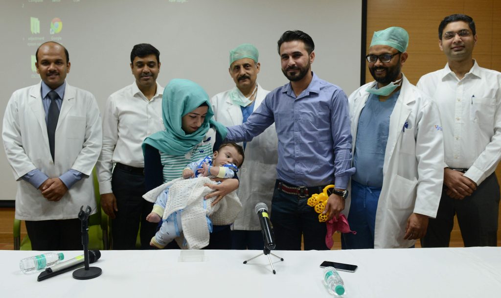Seven-month-old baby who was born with EIGHT LIMBS has successfully surgery Near Delhi Seven-month-old baby who was born with EIGHT LIMBS has successfully surgery Near Delhi