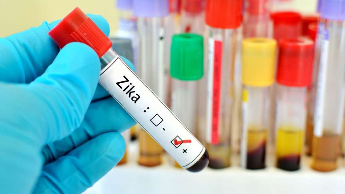 Zika virus also may have harmful heart effects, research shows in first report in adults Zika virus also may have harmful heart effects, research shows in first report in adults