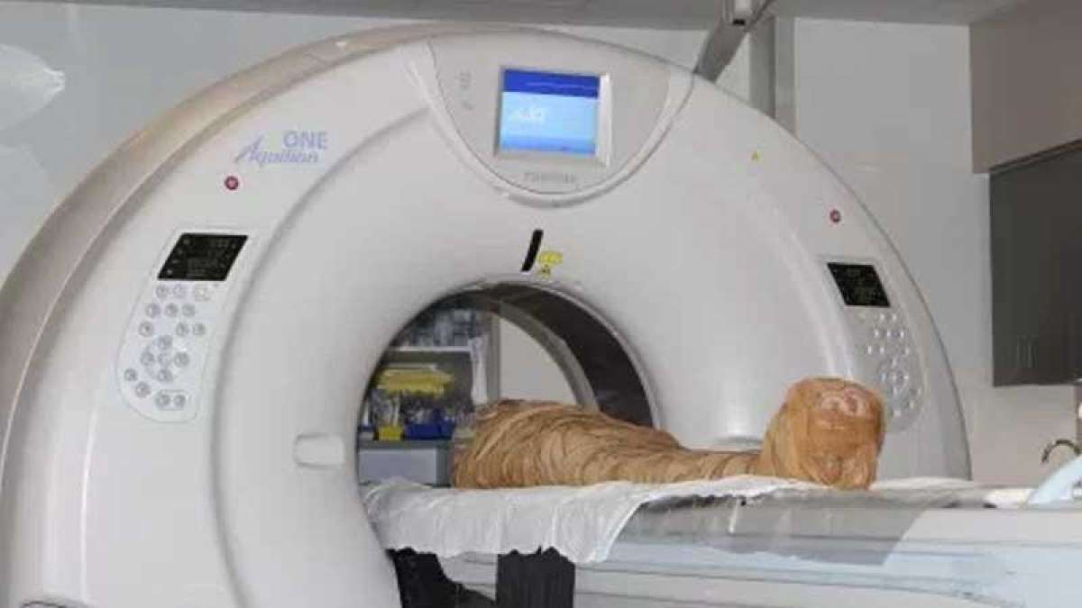 2000 year old Cazenovia mummy 'Hen' undergoes CT scan at Crouse Hospital 2000 year old Cazenovia mummy 'Hen' undergoes CT scan at Crouse Hospital