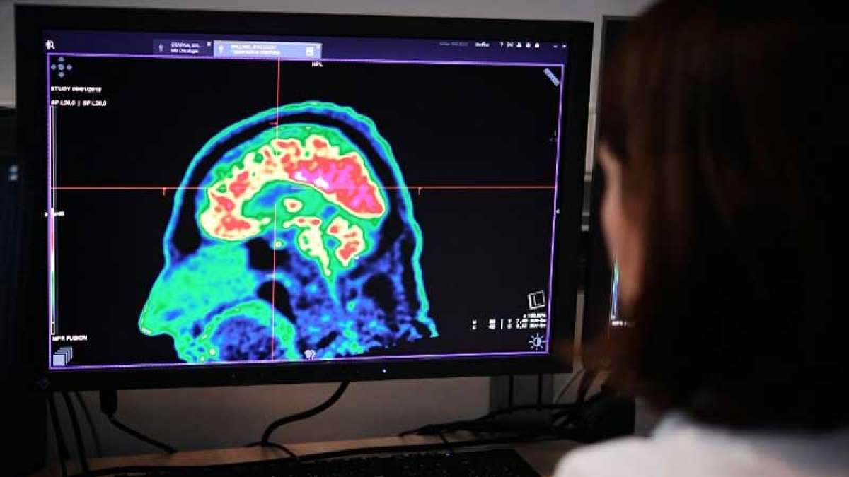Women's brain 4 years younger than men: Study Women's brain 4 years younger than men: Study