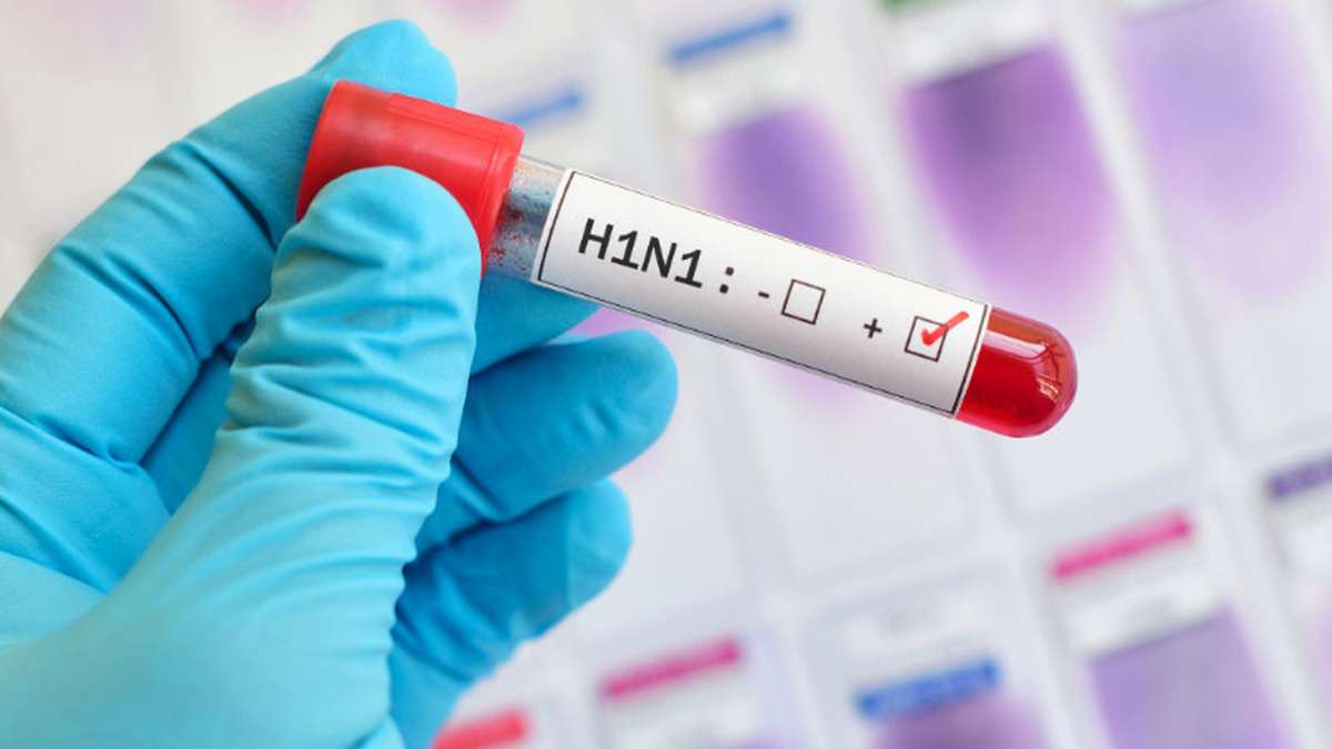 Swine flu is caused by one of the swine influenza viruses (SIV) and H1N1 strain is most common across India Swine flu is caused by one of the swine influenza viruses (SIV) and H1N1 strain is most common across India