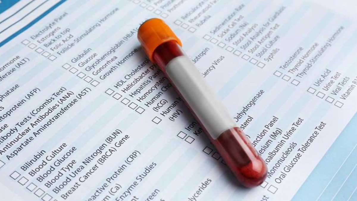 7 important preventive tests that you must undergo 7 important preventive tests that you must undergo